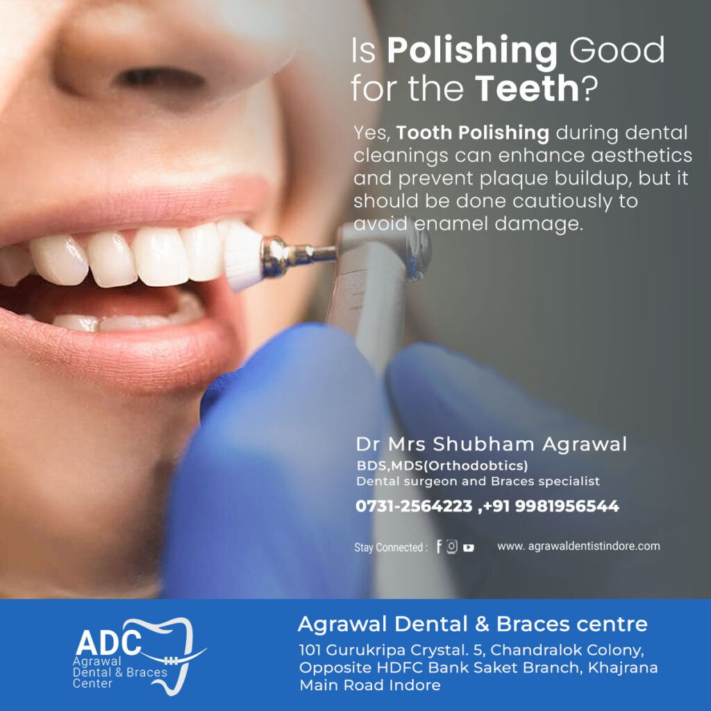 Is Polishing Good for the Teeth?